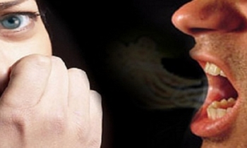 Alitosi: storia, cause e consigli